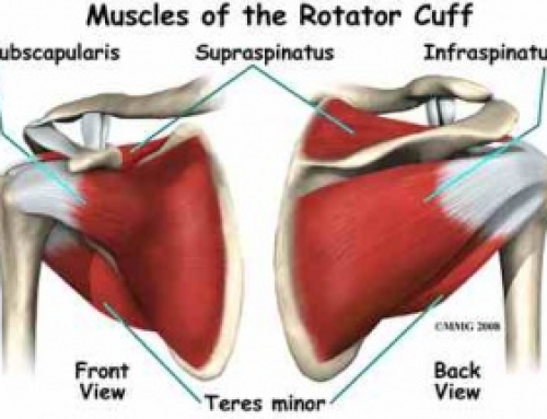 Do my shoulders hurt because of my posture?