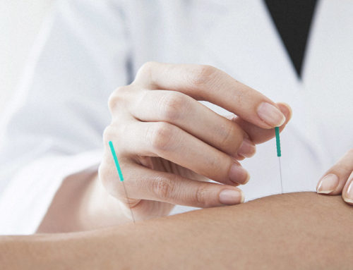 What is Dry Needling?